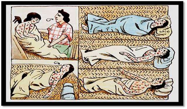 Epidemia de Sarampión