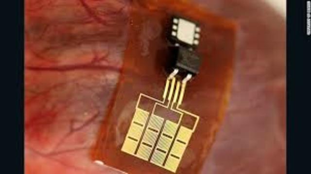 Electrónica implantada