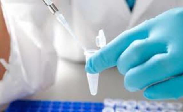 Biopsia liquida contra el cancer.