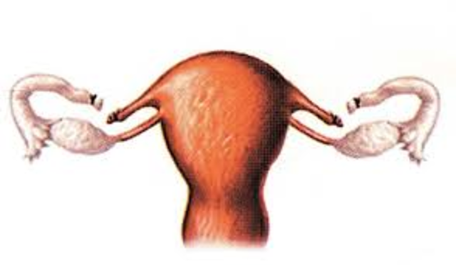 Ligaduras de trompas