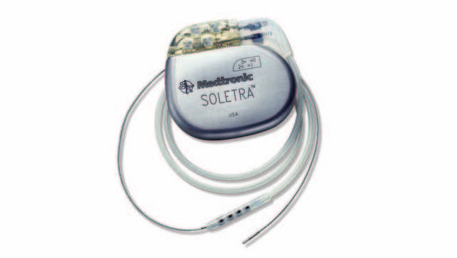 Primera implantación de marcapasos