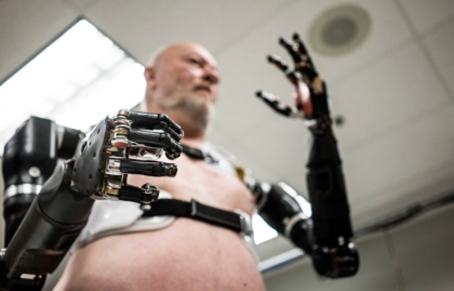 Removedor de coágulos para victimas de derrame cerebral