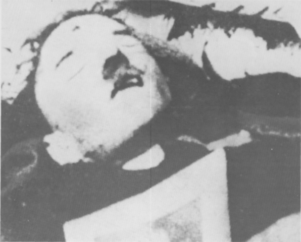 Hitler commits suicide