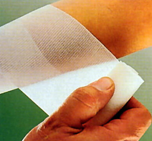 Luis Cervantes curo a Demetrio.