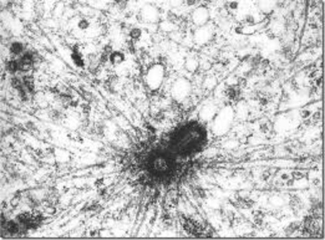 Estudio y descubrimiento del centrosoma