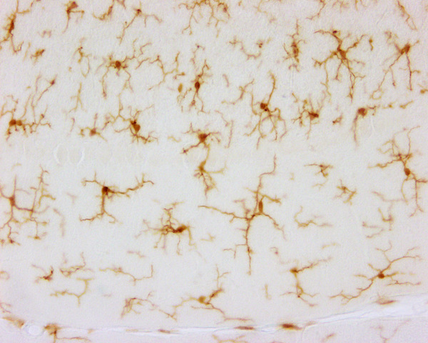 Descubrimiento del la microglia y miedo a publicar sus investigaciones por miedo al enfado de Cajal
