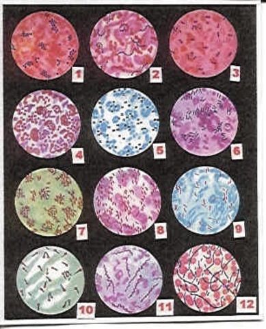 Creación de un nuevo método histológico (coloración)