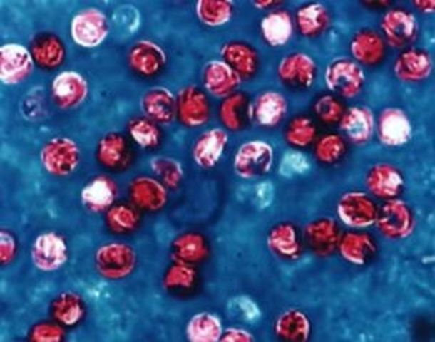 Cryptosporidium Outbreak