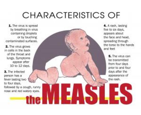 Measles