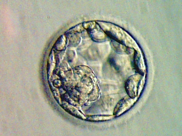 Dia 5: Blastocisto tardío