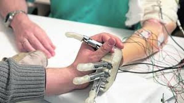 UN GRUPO DE CIENTIFICOS ITALIANOS DESARROLLA EL PRIMER PROTOTIPO DE MANO ARTIFICIAL