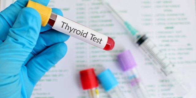Thyroid Test