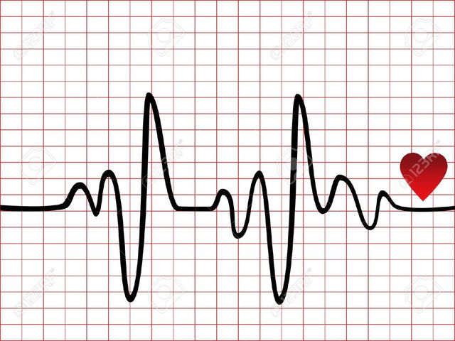 Baseline EKG