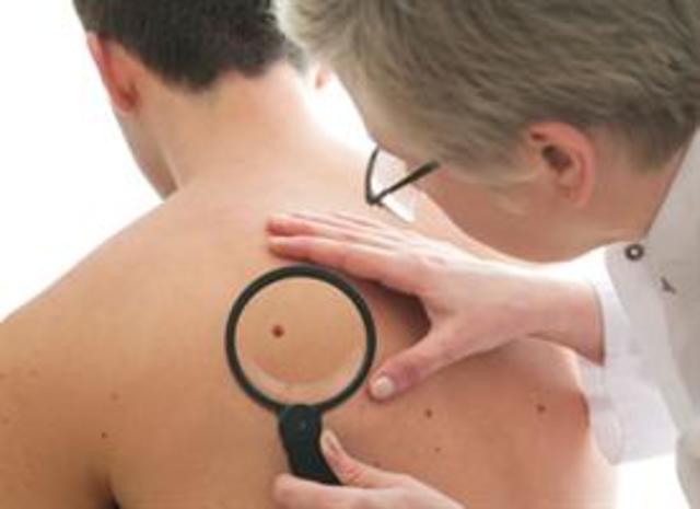 Skin Cancer Screening