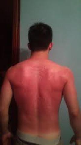 día después de las albercas