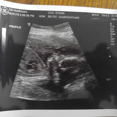Baby Number two!