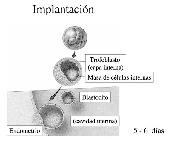 Implantación. 6to día.