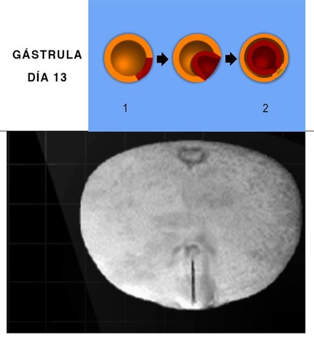 Gástrula. Día 13