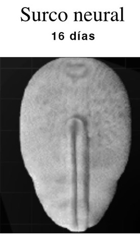 Surco neural. Día 16