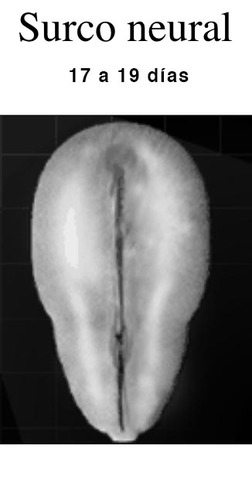 Surco neural. Día17.