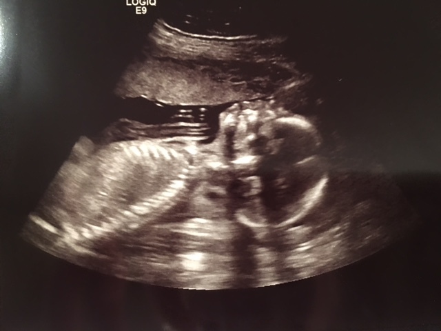 Doctor's appointment