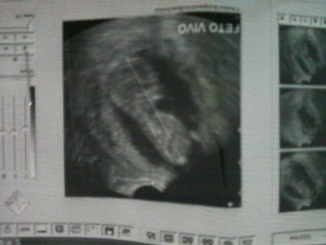 Desde mis comienzo de vida