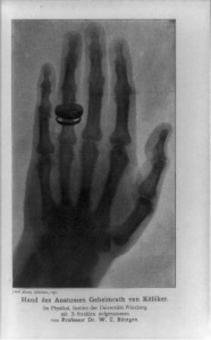 X-Ray