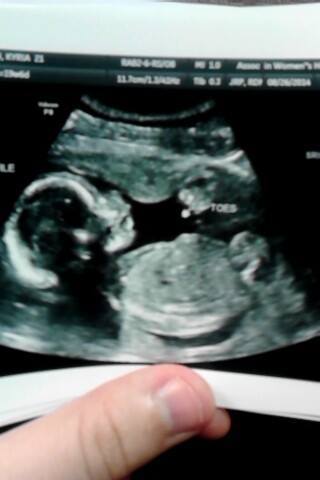 Addition Announcement