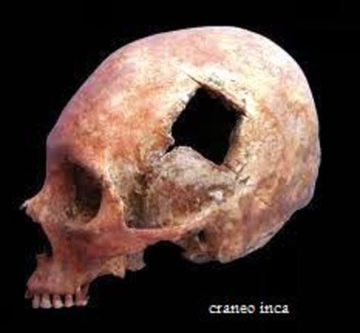 UNA EPIDEMIA DE TIFUS EXANTEMATICO PROVOCA LA MUERTE DE APROXIMADAMENTE 5000 PERSONAS