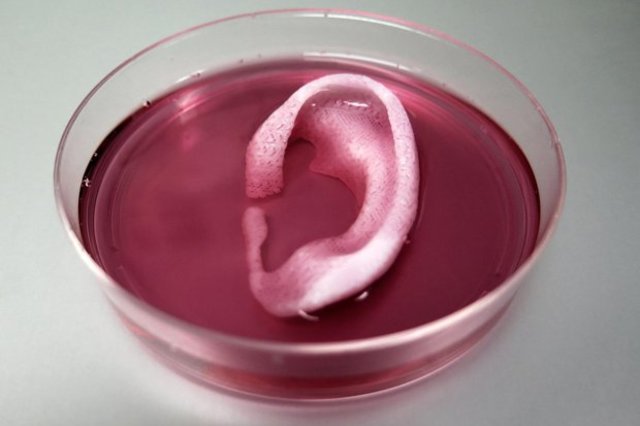 First Lab Grown Organ Implanted in Humans