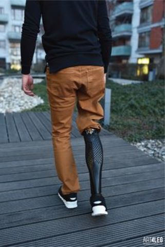 First Person to Walk with 3D Printed Leg