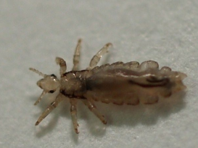 Epidemia de TIFUS, provoca la muerte de 5.000 personas Aproximadamente