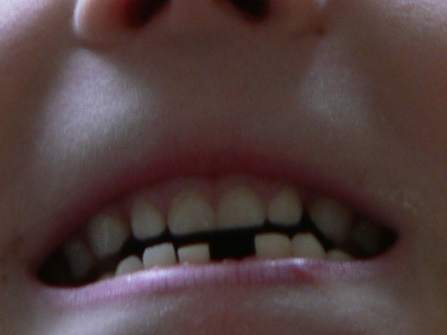 Age 4 lost my First Tooth