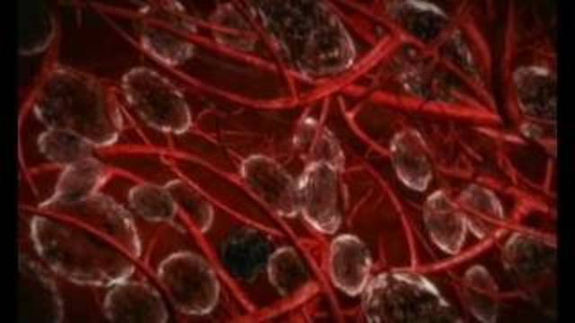 una epidemia de tifus exantematico provoca la muerte de aprox. 5.000 personas