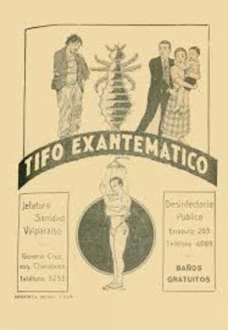 una epidemia de tifus exantemático  provoca la muerte de 5.000 personas.