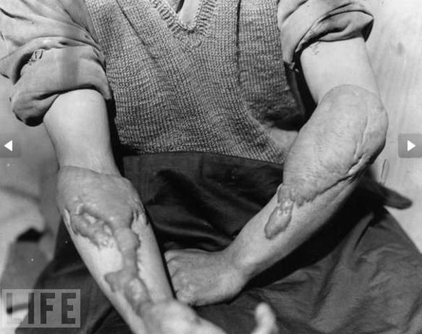 ¿Primeros auxilios? Detalle que se ignoraba