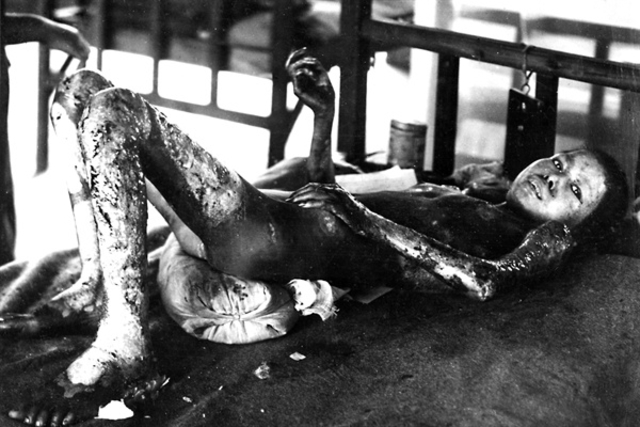 "Los niños de Hiroshima"