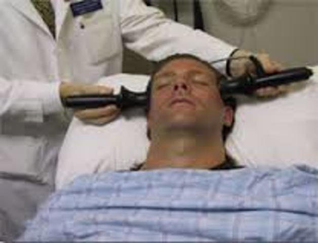 Electroconvulsive Therapy Begins