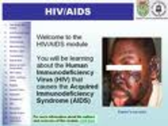 First death by HIV/aids