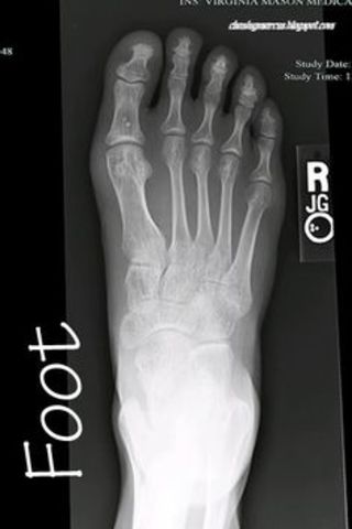 X-rays