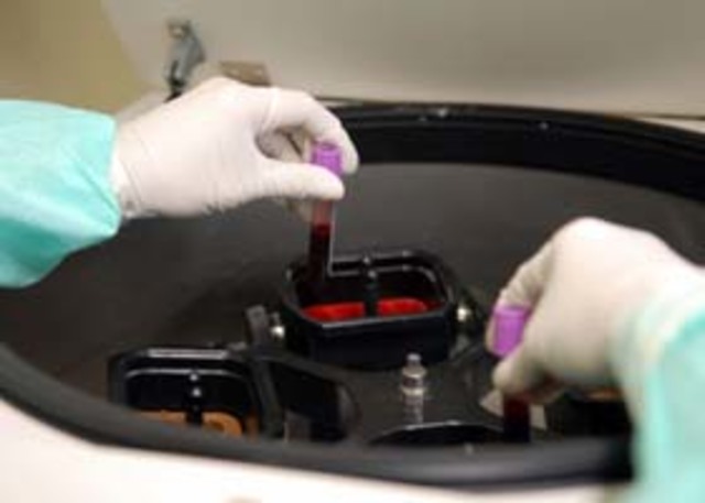 Ameaça de quebra de patentes