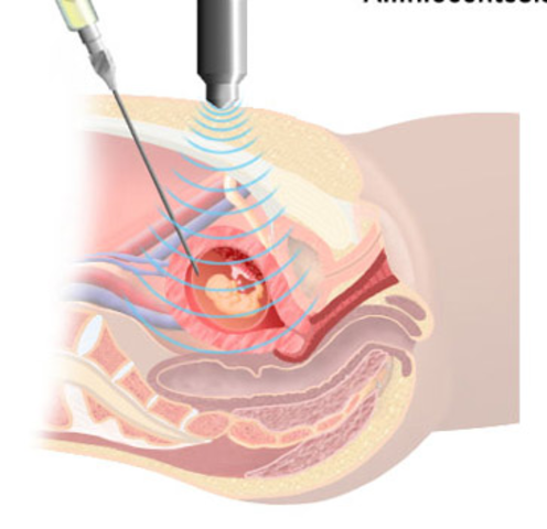 Diagnostico prenatal.