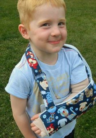 I broke the arm with 2 years old.