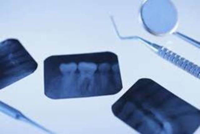 historia de la pelicula dental