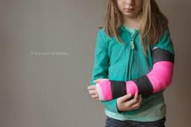 Broken arm