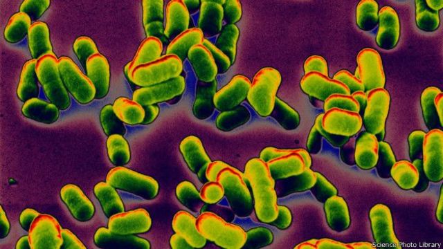 "ME LLAMO PASTEURELLLA PESTIS"-- Peste Negra"