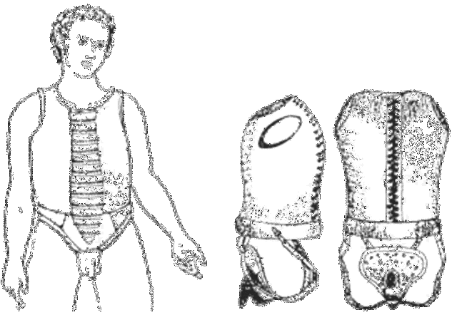 Efforts to bring child abuse under control