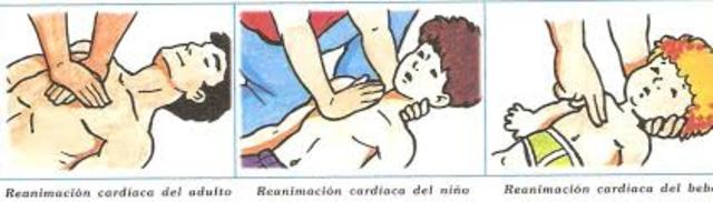 Técnicas de reanimación