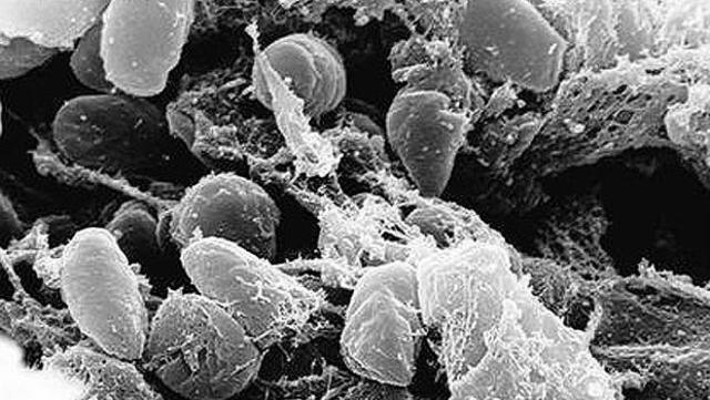 Bubonic Plague