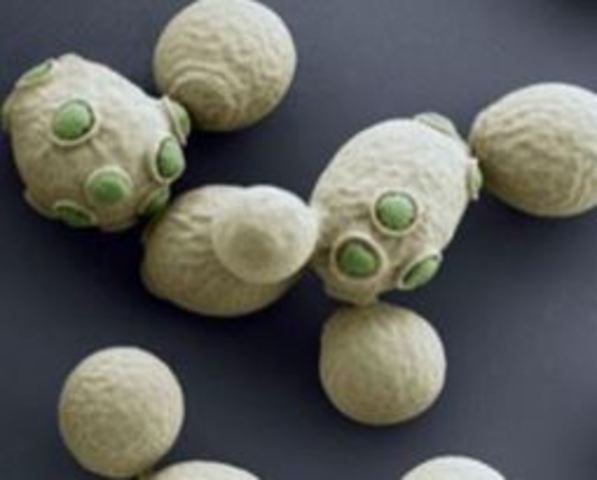 Sintesis artificial de gen de levadura.